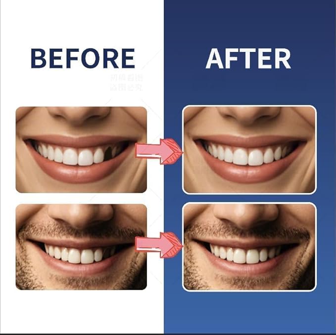 Tooth Repair Kit,Temporary Natural Shade for Filling The Gap, Moldable Thermal Beads Replacement Kit Replace The Missing or Broken Tooth-6PCS-TK05