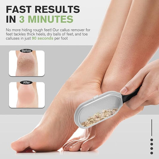 FERYES Foot File Callus Remover with Dead Skin Catcher – The Genius Foot Scrubber for Mess-Free Pedicures, Heel Scraper for Cracked Heel Treatment, Wet & Dry Use Feet Rasp - Black