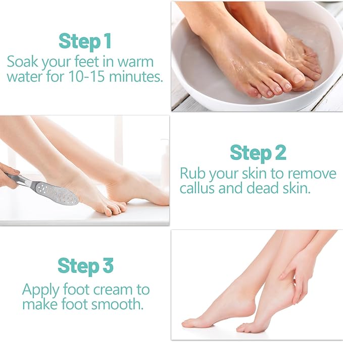 Foot File Callus Remover Stainless Steel Double Sided Foot Scraper, Foot Rasp for Dry and Wet Skin, Pedicure Tool for Feet Hard Skin and Cracked Heels
