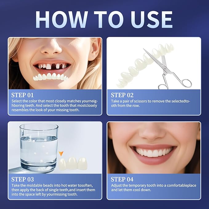 Tooth Repair Kit,Temporary Natural Shade for Filling The Gap, Moldable Thermal Beads Replacement Kit Replace The Missing or Broken Tooth-6PCS-AK02