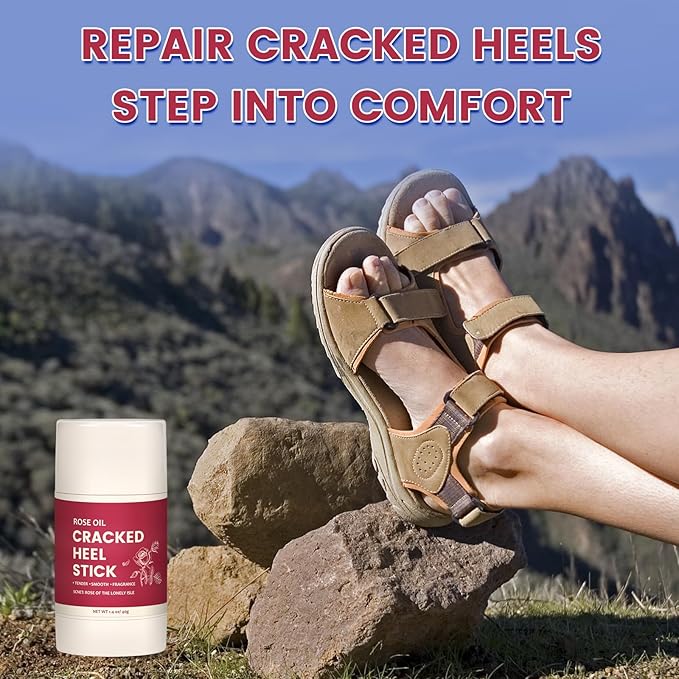 TEAWOO 2 Pcs Cracked Heel Treatment & Repair Stick Set (Foot Balms + Heel Socks) – Rose Oil Infused Cracked Heel Stick Balm for Dry, Cracked Heels – No-Mess Applicator, Travel-Friendly