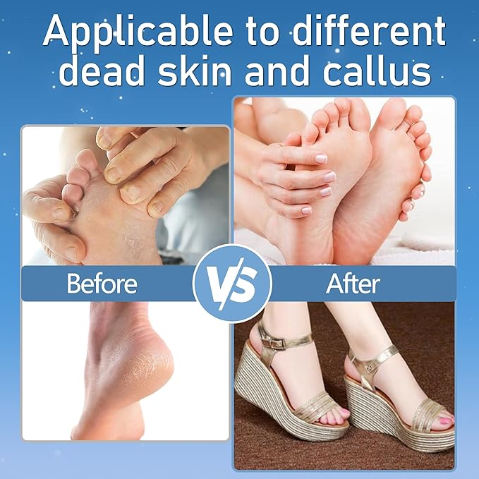 Callus Remover for Feet, Electric Foot Callus Remover Waterproof with 3 Rollers 2 Speed Battery Display,17 in1 Rechargeable Foot File Pedicure Kits for Dead Hard Cracked Dry Skin(White