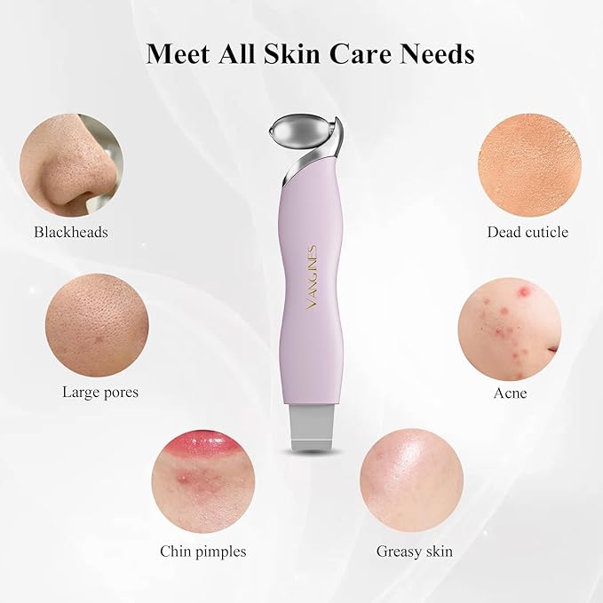 Blackhead Remover Tool with Ice Roller, Stainless Steel Face Scraper, Skin Scrubber Face Spatula for Deep Cleansing, 3-in-1 Skin Care Tool with 2 Silicone Brush Heads(Berry Mauve)