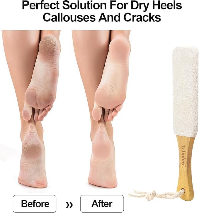 Foot File Foot Scrubber Pedicure, Pumice Stone for Feet, 2 Pack Professional Foot Scrubber Remove Cracked Heels,Dead Skin,Corn,Scraper File Foot Care Foot Rasp Massage Brush Tools Kit for Men/Women