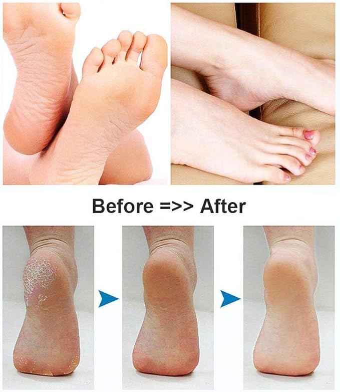 Electric Foot Scrubber Foot File Hard Skin Remover Pedicure Tools Electronic Callus kit for Cracked Heels and Dead Skin with 2 Roller Heads, White