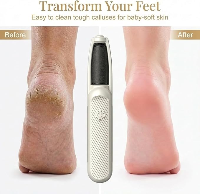 Callus Remover for Feet, Electric Foot File and Callus Remover, Professional Pedicure Tools for Dry, Calluses, Dead, Cracked, Hard Skin (1 Set)