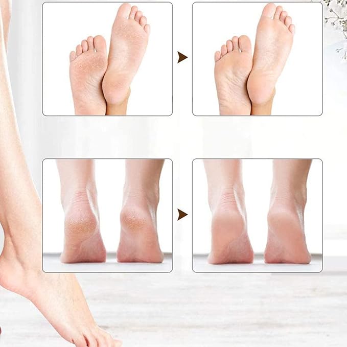 Pongnas Portable Electric Feet Callus Remover Rechargeable, Professional Foot File Scrubber Pedicure Tools with 2 Gears, Pedicure Tools kit Feet Care for Dead Skin Cracked Heels