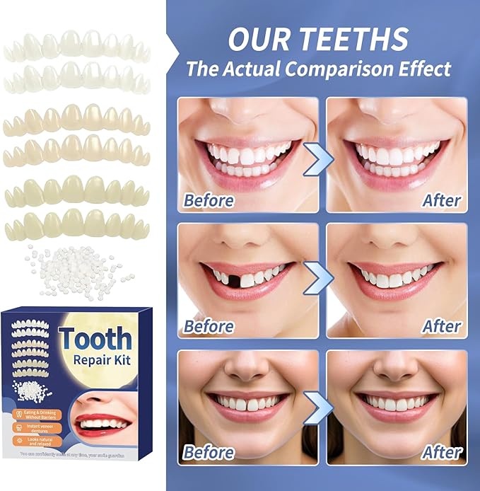 Tooth Repair Kit，Temporary Natural Shade for Filling The Gap, Moldable Thermal Beads Replacement Kit Replace The Missing or Broken Tooth-6PCS-AK02
