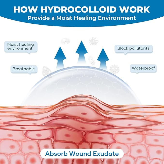 Hydrocolloid Bandages Roll: 2in x 5ft Ultra Adhesivas & Absorbent & Waterproof Large Hydrocolloid Patches for Wound Care Hydro Seal Wound Healing Hydrocolloid Dressing Bandaid Tape
