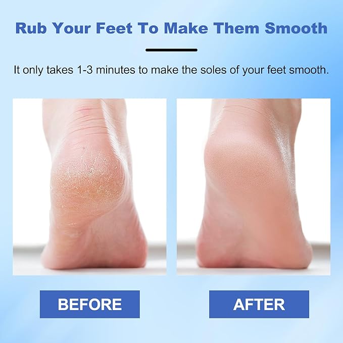 2pcs Hard Skin Remover Nano-Glass Foot File, Nano Glass Foot File with Non-Slip Ergonomic Handle, Professional Foot Care Tools (Gold+Blue)