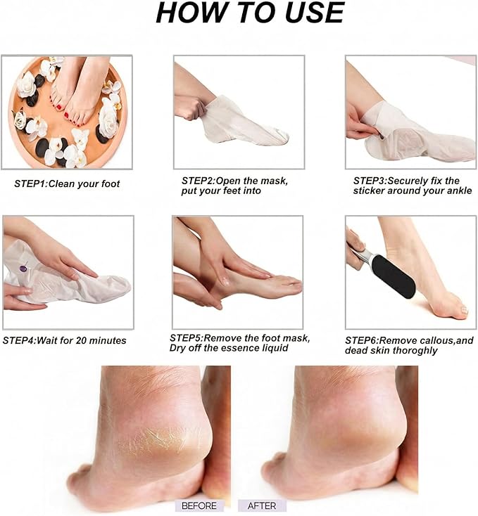 Stainless Foot File Callus Remover for Cracked Heels & Dead Skin — Pedicure Rasp with 10 Replacement Pads & 2 Exfoliating Foot Masks, Sandal Season Foot Care Kit (3in1 Set)