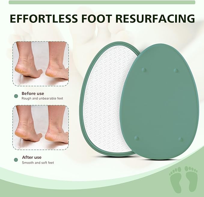 BALUCA Glass Foot File Callus Remover for Feet - Nano Glass Foot Scraper Scrubber Dead Skin Removal for Cracked Heels,Professional Pedicure Tool for Home, Salon, and Travel (Green)