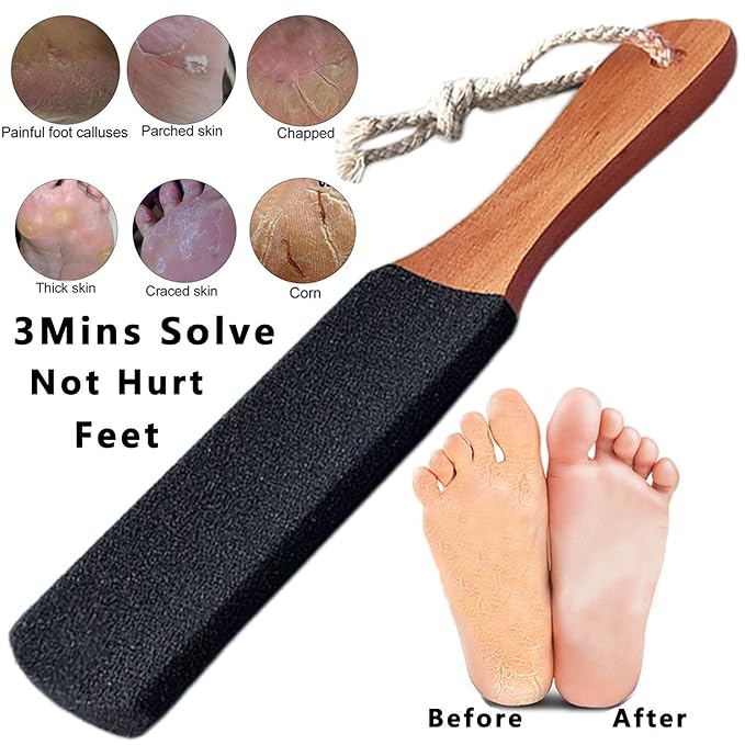 Kinepi Foot Scrubber Pedicure Foot File Pumice Stone,Professional Pedicure Supplies Callus Remove Cracked Heels,Dead Skin,Corn,Scraper File Foot Care Foot Rasp Massage Brush Tools Kit for Men/Women