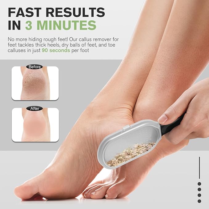 FERYES Foot File Callus Remover with Dead Skin Catcher – The Genius Foot Scrubber for Mess-Free Pedicures, Heel Scraper for Cracked Heel Treatment, Wet & Dry Use Feet Rasp - Black