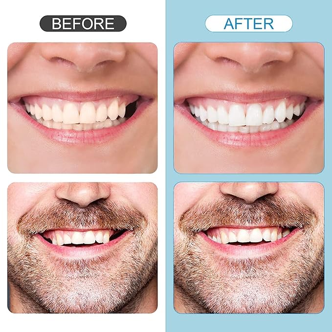 Tooth Repair Kit，Temporary Natural Shade for Filling The Gap, Moldable Thermal Beads Replacement Kit Replace The Missing or Broken Tooth-6PCS-3Colors