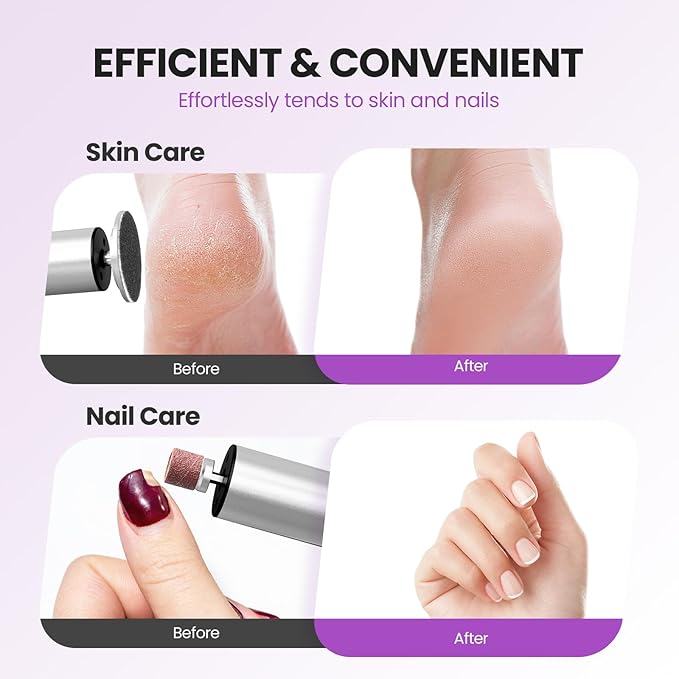 Electric Foot Callus Remover, 2 in 1 | 6 Speed Adjustable Foot File Nail Grinder with Sandpaper Disks, Professional Sander Pedicure Tool for Feet Dead Skin, Self Care Gifts for Women Mom Lover Friends