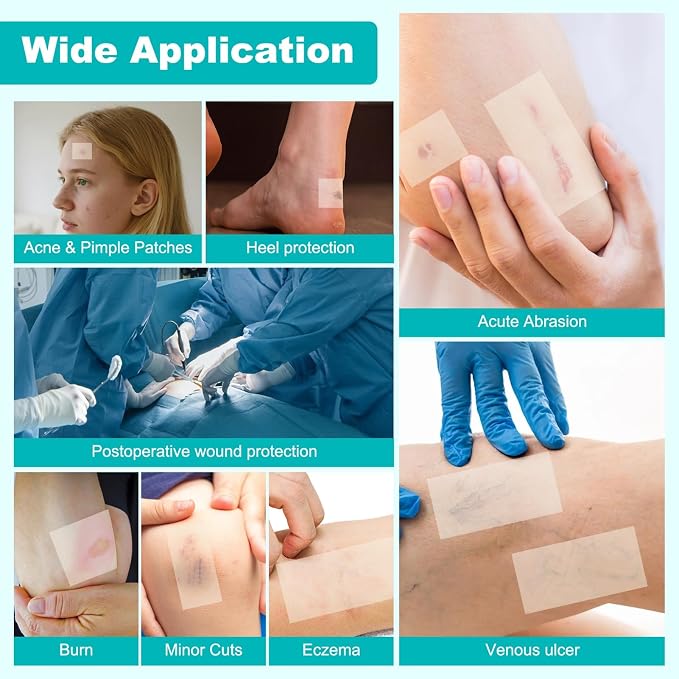 Hydrocolloid Roll for Wound Care, Hydrocolloid Bandages with Self-Adhesive, Cut-to-Size Patch Bandages, Ultra Absorbent, Waterproof, First Aid Kit Essential (2IN*12FT)