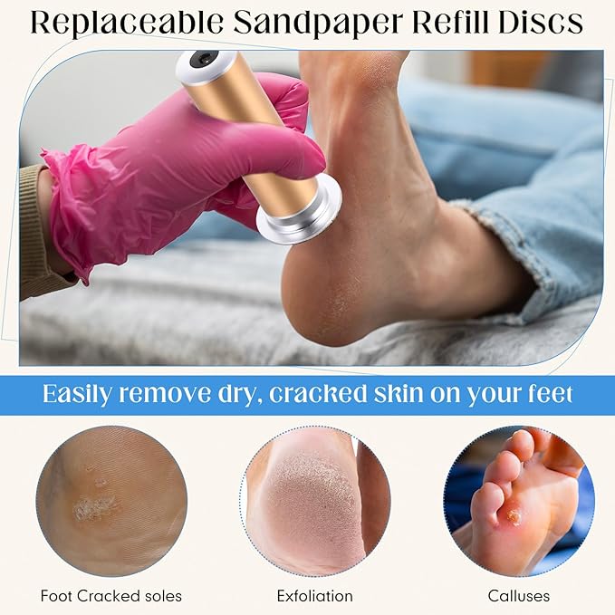 Gisafai 250 Pcs 180 Grit Sanding Replacement Pad Bulk Sandpaper Disk for Electric Foot File Callus Remover Tool Black Foot File Disc for Men Women Heels Dead Cracked Skin Dry Dead Skin Removal