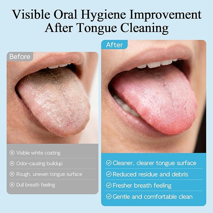 Silicone Tongue Scraper & Brush for Adults, Soft Tongue Cleaner for Bad Breath, Gentle Flexible Bristles Remove Tongue Coating & Food Residue, Non-Metal Oral Hygiene Tool for Fresh Breath