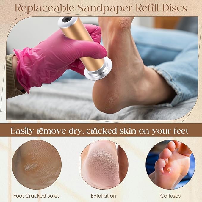 Gisafai 250 Pcs 100 Grit Sanding Replacement Pad Bulk Sandpaper Disk for Electric Foot File Callus Remover Tool Black Foot File Disc for Men Women Heels Dead Cracked Skin Dry Dead Skin Removal