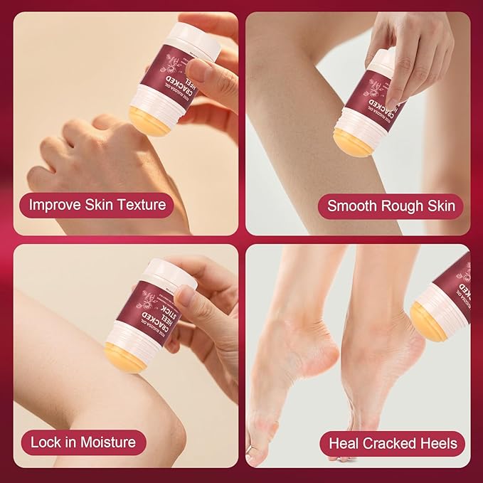 TEAWOO 2 Pcs Cracked Heel Treatment & Repair Stick Set (Foot Balms + Heel Socks) – Rose Oil Infused Cracked Heel Stick Balm for Dry, Cracked Heels – No-Mess Applicator, Travel-Friendly