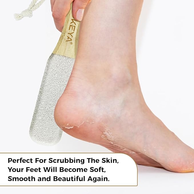 Foot File Scrubber for Dead Skin Remover, Callus Remover for Cracked Heel, Professional Feet Grater Rasp Scraper Corns Callous Removers Tool with Wooden Handle to Hard Skin Corns for Dry & Wet Fee