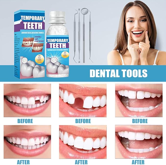 Fake Teeth Repair Kit, Moldable False Teeth Beads for Teeth Repair, Suitable for Missing, Cracked Denture Kit, Smile Confidently Again (1)