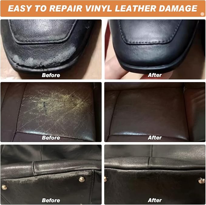 SEISSO Leather Repair Kit with Backing Fabric – 5 Color Leather & Vinyl Repair Kit for Couch, Sofa, Car Seats & Jackets, Fix Tears, Holes, Cracks, Scratches & Burn Holes, DIY Leather Repair (5 Colors)