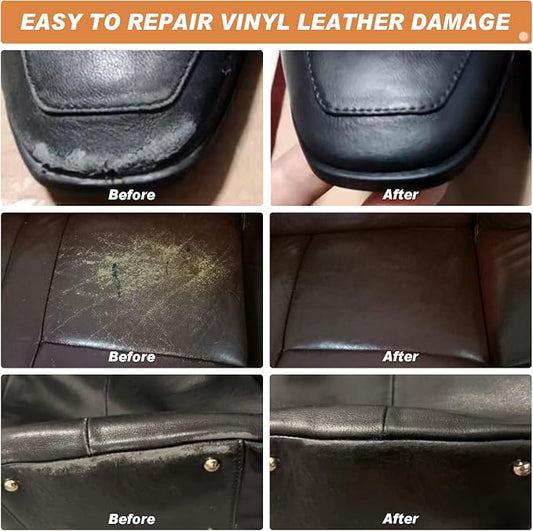SEISSO Leather Repair Kit with Backing Fabric – 5 Color Leather & Vinyl Repair Kit for Couch, Sofa, Car Seats & Jackets, Fix Tears, Holes, Cracks, Scratches & Burn Holes, DIY Leather Repair (5 Colors)