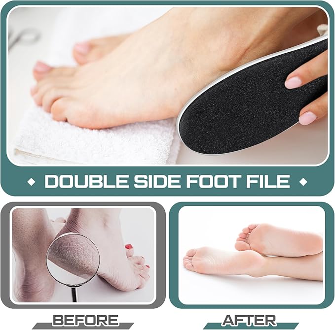 Lothee 15 Pack Foot File Foot Callus Remover Double Sided Professional Sandpaper Pedicure Tool Feet Scrubber Sander Feet Rasp for Dead Skin Cracked Heel Women Manicure Beauty Spa, 100/180 Grit, White