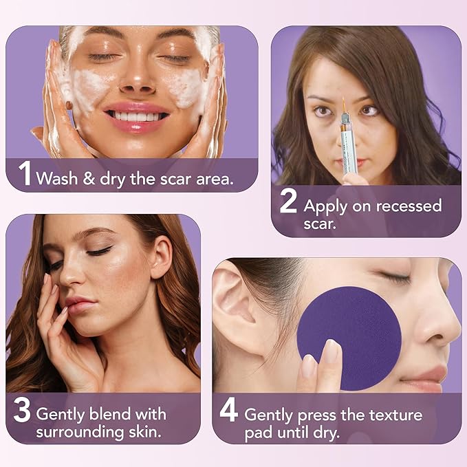 Dermaflage Scar Filler Kit - Tan - Deep Scar Cover and Waterproof Concealer for Acne Scars Wrinkles, and Ice Pick Scars Makeup, 1 mo supply