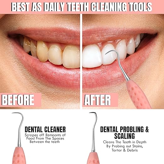 Professional Dental Tools Tartar Scraper for Dentist, Personal Use and Pets Plaque Remover for Teeth, Premium Oral Care Double Ended Dental Scaler | U5/33 Stainless Steel (Pink, Silicone Handle)