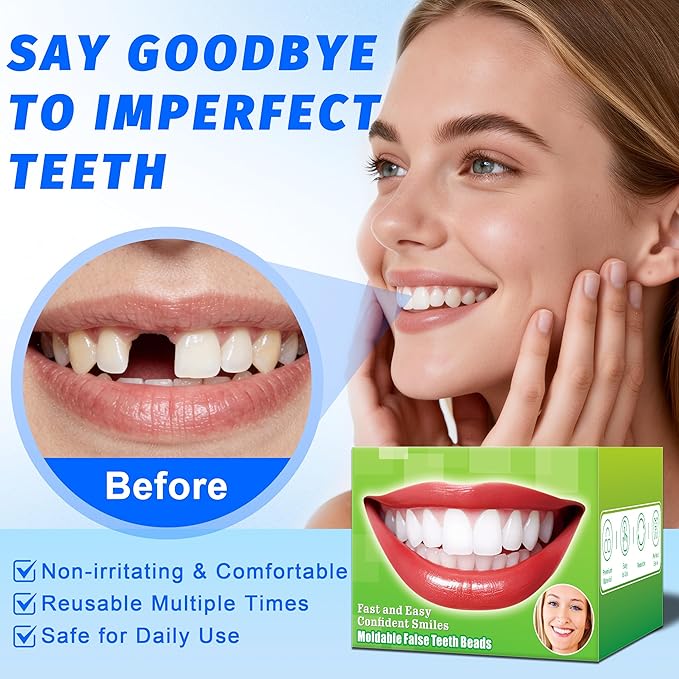 Temporary Tooth Repair Kit, Moldable False Teeth Beads | Fix Broken, Chipped, or Missing Teeth, Cavity Fillings & Loose Dentures in Minutes at Home – Smile with Confidence