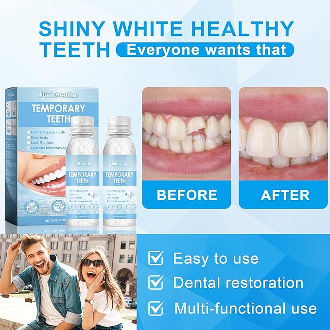 Tooth Repair Kit – 2PCS Temporary Tooth Filling, Moldable False Teeth Beads for Teeth Repair
