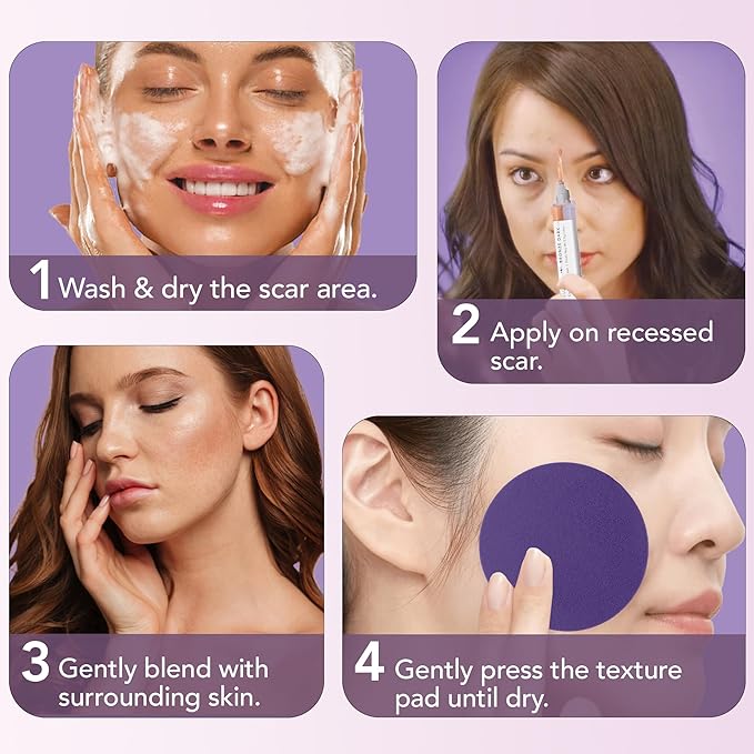 Dermaflage Scar Filler Kit - Bronze Dark - Deep Scar Cover and Waterproof Concealer for Acne Scars Wrinkles, and Ice Pick Scars Makeup, 1 mo supply