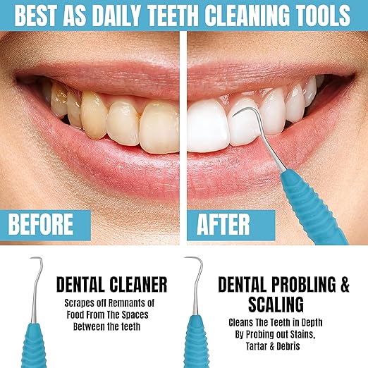 Professional Dental Tools Tartar Scraper for Dentist, Personal and Pets Use Plaque Remover with Comfortable Grip, Double Ended Silicon Grip Scaler H5/33 (Aqua)