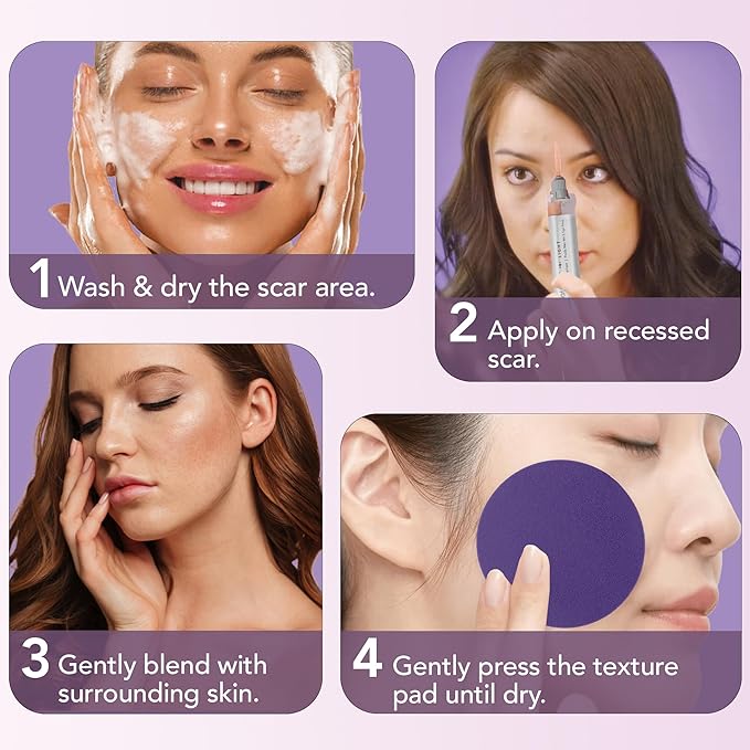 Dermaflage Scar Filler Kit - Light - Deep Scar Cover and Waterproof Concealer for Acne Scars Wrinkles, and Ice Pick Scars Makeup, 1 mo supply