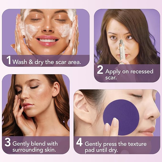 Dermaflage Scar Filler Kit - Fair- Deep Scar Cover and Waterproof Concealer for Acne Scars Wrinkles, and Ice Pick Scars Makeup, 1 mo supply