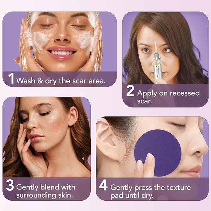 Dermaflage Scar Filler Kit - Golden Fair - Deep Scar Cover and Waterproof Concealer for Acne Scars Wrinkles, and Ice Pick Scars Makeup, 1 mo supply