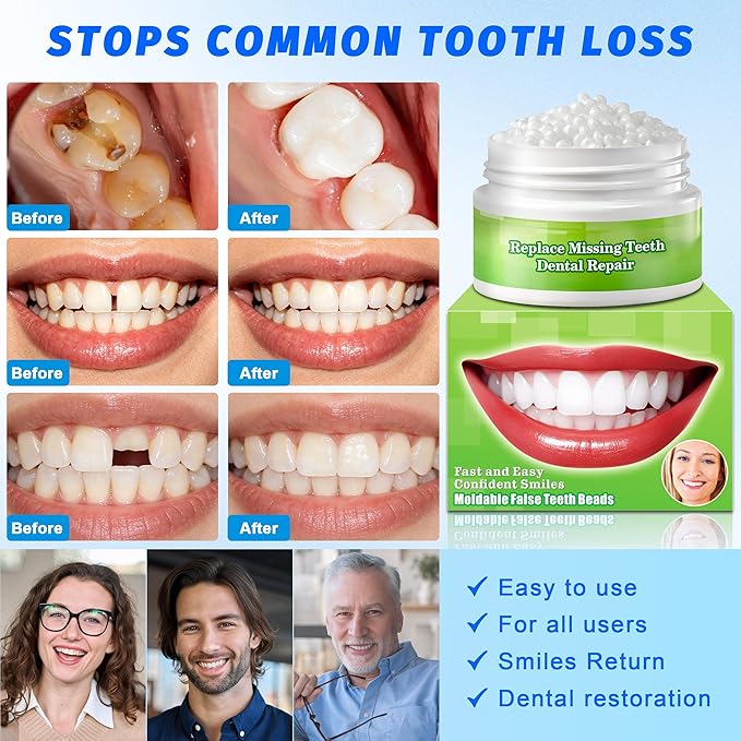 Temporary Tooth Repair Kit, Moldable False Teeth Beads | Fix Broken, Chipped, or Missing Teeth, Cavity Fillings & Loose Dentures in Minutes at Home – Smile with Confidence